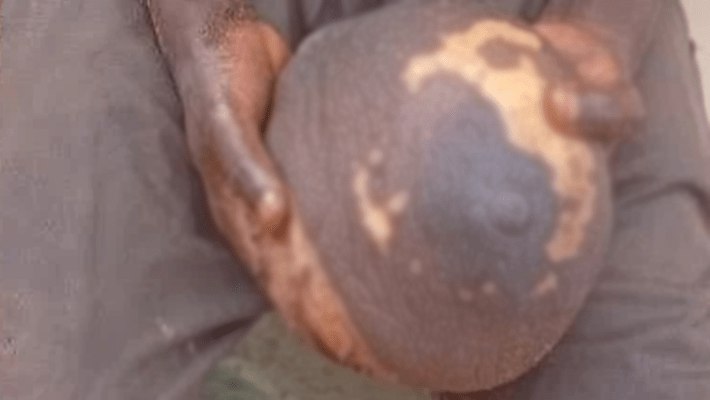 Police Nab Anambra Man With Fresh Human Breast